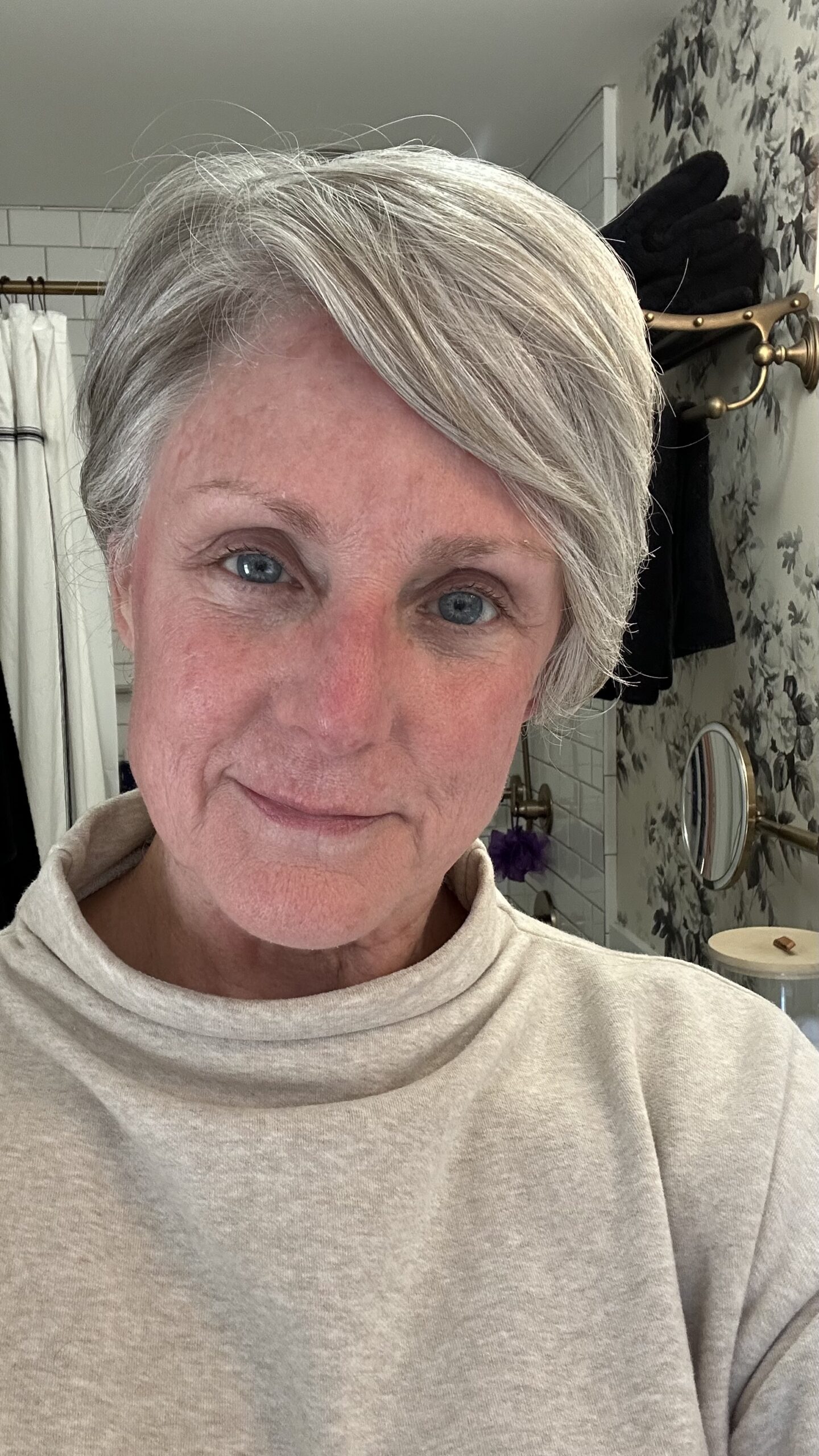 Chemical Peel Day 5 Chemical Peel Day 5