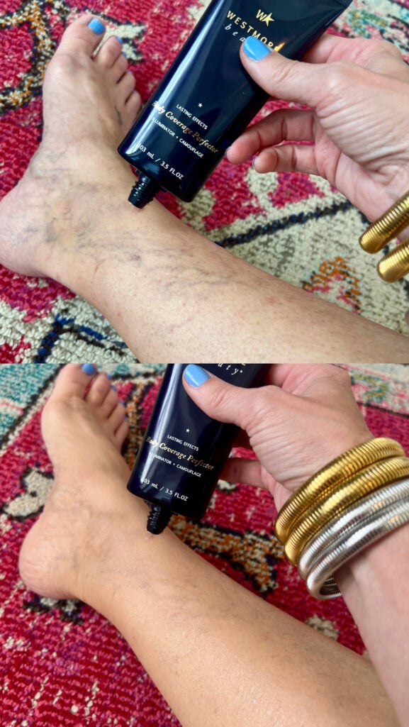 Before-and-after comparison of a woman's lower leg and ankle, showing visible varicose veins in the top image and smooth, even-toned skin in the bottom image after applying Westmore Beauty Body Coverage Perfector, with gold and silver stacked bracelets