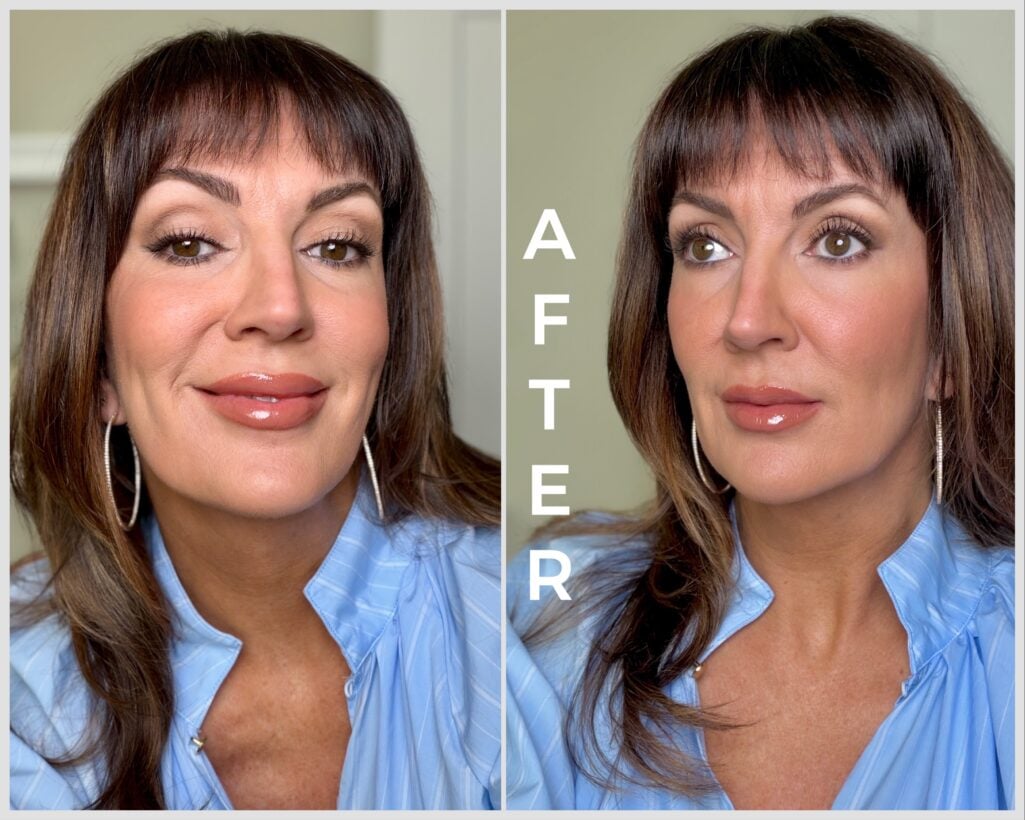 After collage showing hooded mature lids